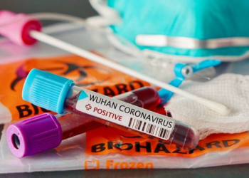 Son sutkada Azərbaycanda 337 nəfər koronavirusa yoluxub - 6 nəfər ölüb