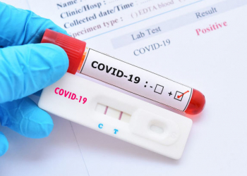 Dünyada son həftə qeydə alınan qorxulu koronavirus statistikası
