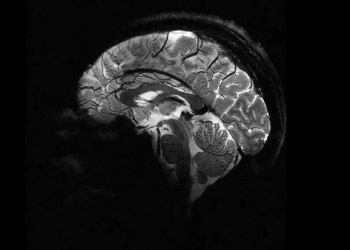 İnsan beyninin ən aydın görüntüsü - Foto