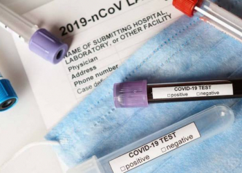 Azərbaycanda son bir ayda 325 nəfər koronavirusa yoluxub, 21-i ölüb